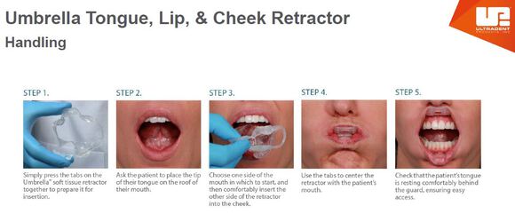 Abreboca - Umbrella Cheek Retractors