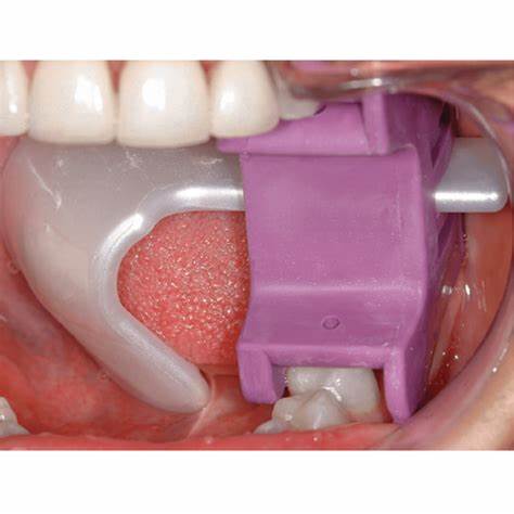 Abre bocas y protector lingual - ProGard Protector Lingual